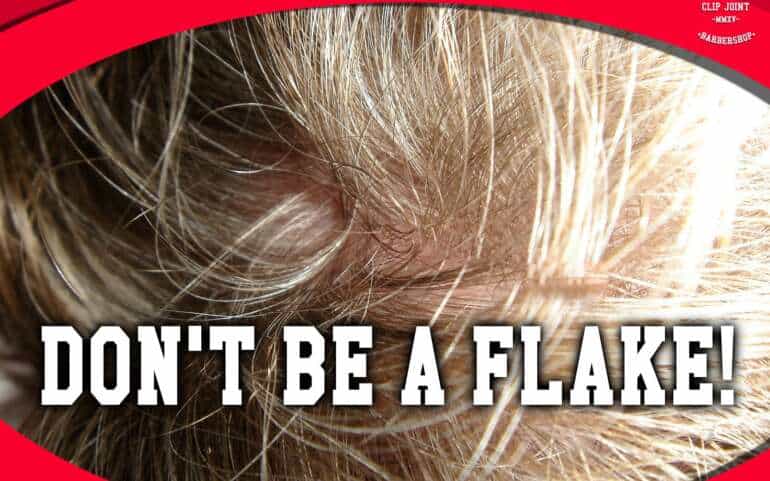 Don’t be a Flake! How to Prevent or Treat Dandruff